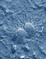 The bacteria (Staphylococcus aureus)
