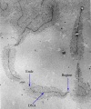 Electron micrograph of Ribosomal RNA transcription units of Chironomus thummi (Diptera). Magnification - 40.000x.