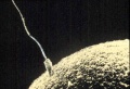 Electron micrograph of a sperm with flagellum penetrating an ovum.