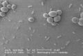 Escherichia coli (little forms) & Saccharomyces cerevisiae (big forms)